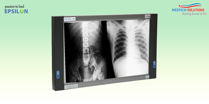 X-Ray Fim viewer (View Box) Double Film